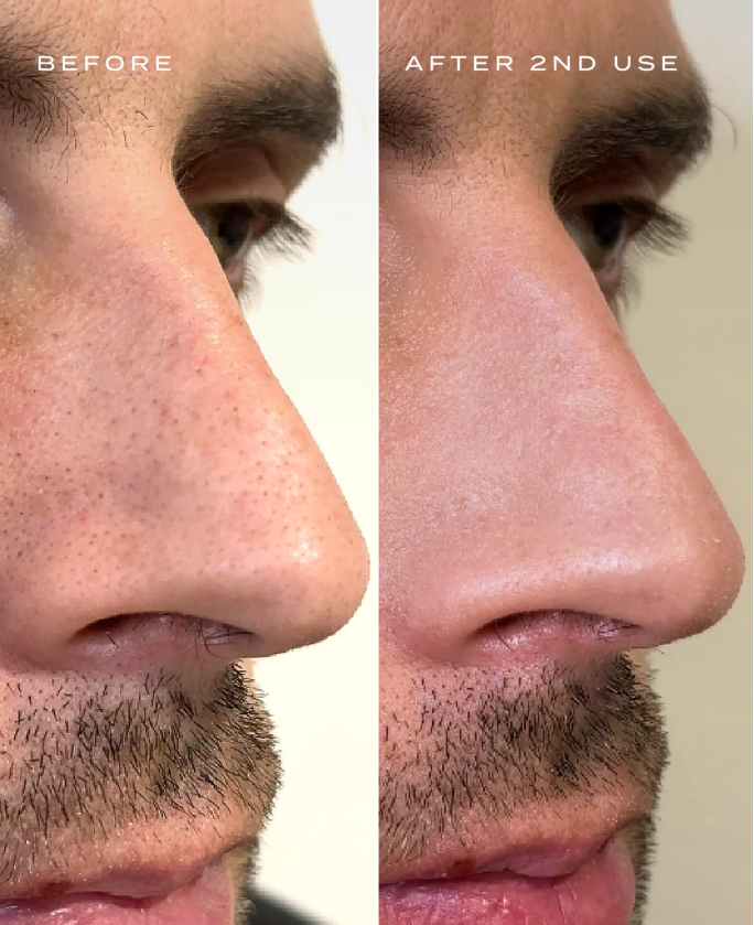 Essence Nose Strips