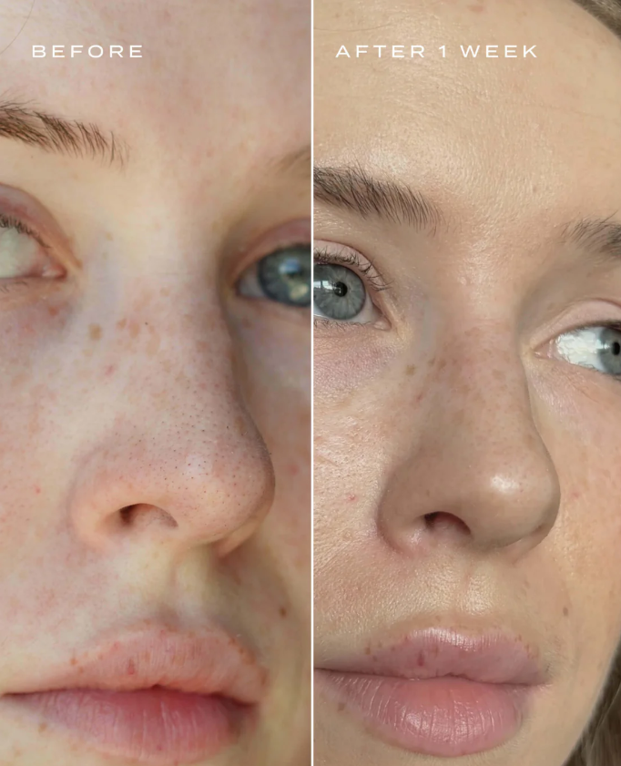 Essence Nose Strips